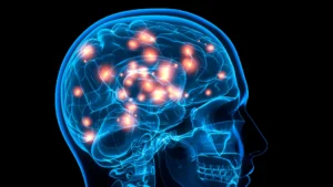 Acquired Brain Injury (ABI)