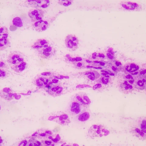 Sepsis Awareness Training – Online Course